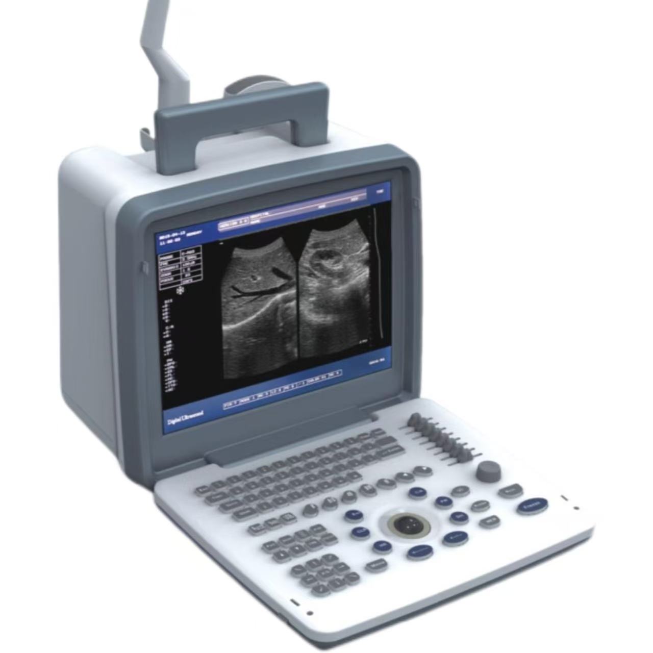 Full Digital Ultrasound Diagnostic System